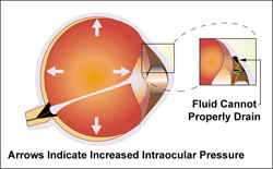 01_glaucoma_with_border